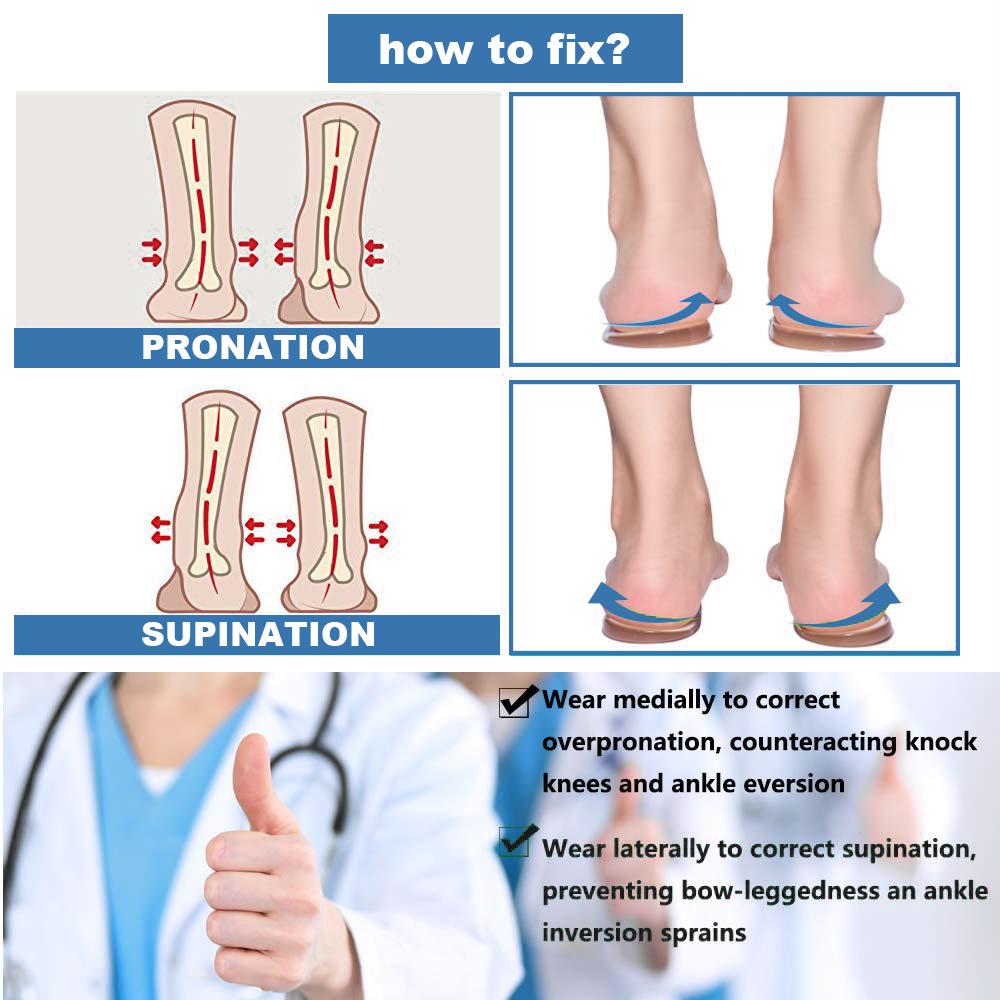 Medial heel deals wedge orthotics